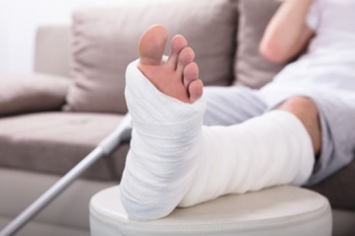 Understanding Stress Fractures in the Feet