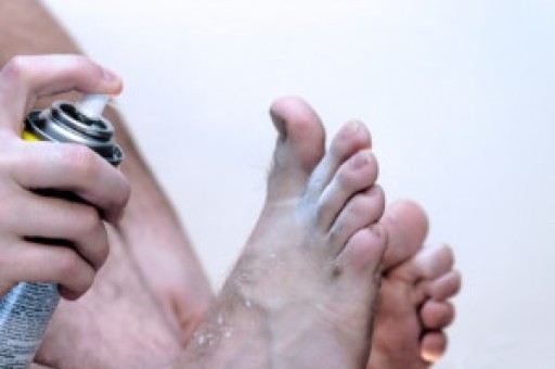 How to Tell if You Have Athlete’s Foot