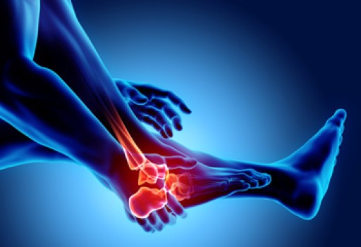 Dealing with Stress Fractures of the Foot and Ankle