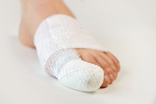 Sports Related Foot And Ankle Injuries