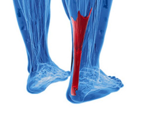 Achilles Tendon Injuries