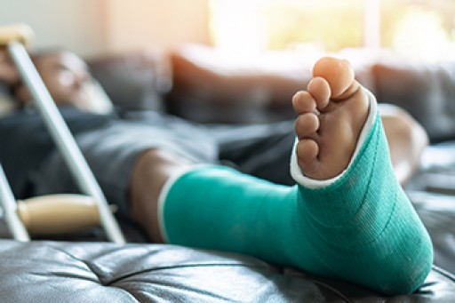 Broken Ankle Causes, Differences, Symptoms and Treatments