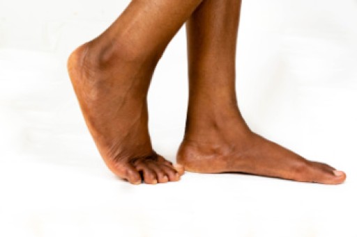 Flat Feet