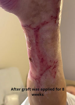 before and after